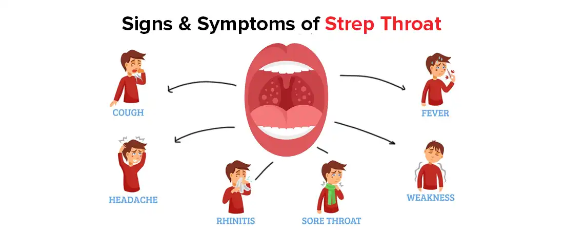 Signs & Symptoms of Strep Throat